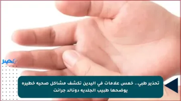 تحذير طبي.. خمس علامات في اليدين تكشف مشاكل صحية خطيرة يوضحها طبيب الجلدية دونالد جرانت